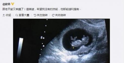 贾静雯得知欧弟老婆郑云灿怀孕3个月的消息,立刻发文表示:"恭喜欧