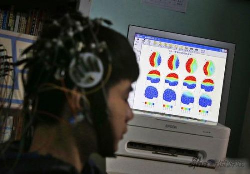 中科院最新研究 少年网瘾患者大脑活动近似吸